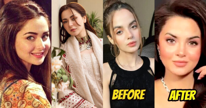 The latest cosmetic method of Pakistani celebrities

